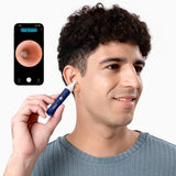 Bebird EarSight Plus Visual Ear Cleaner