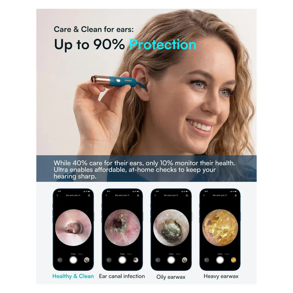 Bebird EarSight Ultra 2K Smart Visual Ear Cleaner